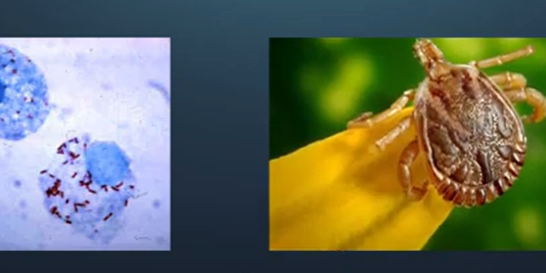 Agente etiológico da febre maculosa