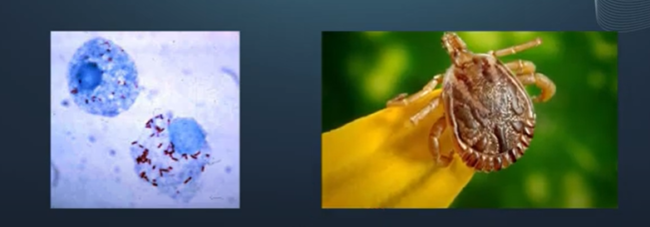 image Agente etiológico da febre maculosa