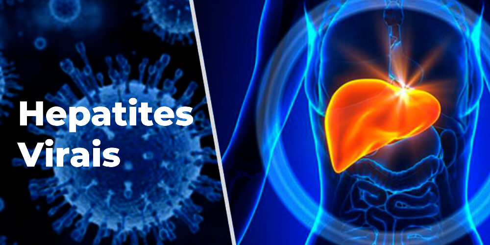Hepatites Virais