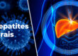 Hepatites Virais