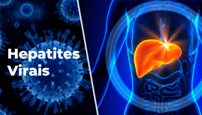 hepatite Hepatites Virais